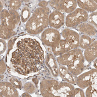 Anti-OSBPL9 Antibody