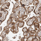 Anti-OSBPL9 Antibody