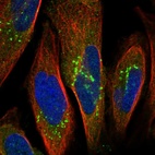 Anti-OSBPL9 Antibody