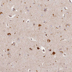 Anti-CHCHD2 Antibody