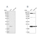 Anti-UFC1 Antibody