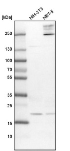 Anti-UFC1 Antibody