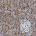 Anti-SPINK1 Antibody