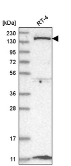 Anti-DGKD Antibody