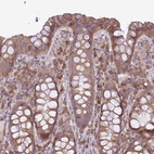 Anti-MOCS3 Antibody