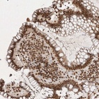 Anti-NKX3-2 Antibody