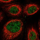 Anti-NKX3-2 Antibody