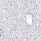 Immunohistochemical staining of human liver shows low expression as expected.