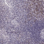 Anti-CDC42SE1 Antibody