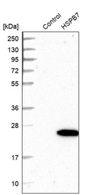 Anti-HSPB7 Antibody