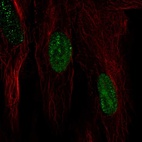 Anti-HSPB7 Antibody