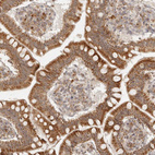 Anti-MRPL55 Antibody