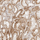 Anti-MRPL55 Antibody