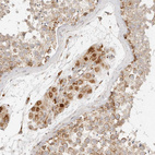 Anti-MRPL55 Antibody