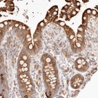 Anti-C1orf127 Antibody