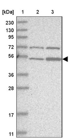 Anti-ZFP69 Antibody