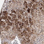 Anti-FAM212B Antibody