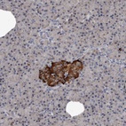 Anti-GREB1 Antibody