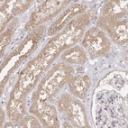 Anti-EEF1E1 Antibody