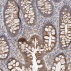 Anti-HINT3 Antibody