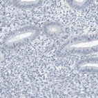 Anti-ZPBP2 Antibody