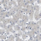 Anti-ZPBP2 Antibody