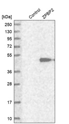 Anti-ZPBP2 Antibody