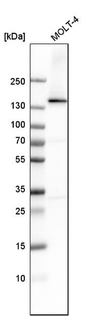 Anti-DHX9 Antibody