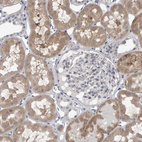 Immunohistochemical staining of human kidney shows moderate cytoplasmic positivity in cells in tubules.