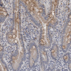 Immunohistochemical staining of human upper dodenum shows weak cytoplasmic positivity in glandular cells.