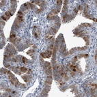 Anti-LRRC6 Antibody