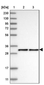 Lane 1: Marker [kDa] 230, 130, 95, 72, 56, 36, 28, 17, 11_br/_Lane 2: Human cell line RT-4_br/_Lane 3: Human cell line U-251MG sp