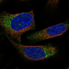 Immunofluorescent staining of human cell line U-2 OS shows localization to endoplasmic reticulum.