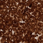 Anti-ERO1B Antibody