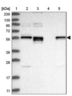 Anti-ERO1B Antibody