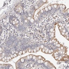 Anti-MYOM3 Antibody