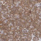 Anti-WDTC1 Antibody