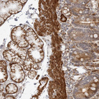 Anti-SRGAP2 Antibody