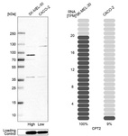 Anti-CPT2 Antibody