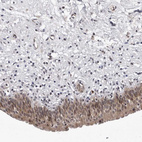 Anti-KIAA1614 Antibody