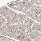 Anti-KIAA1614 Antibody