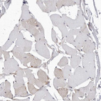 Anti-KIAA1614 Antibody