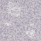 Anti-FABP1 Antibody