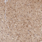 Anti-FABP1 Antibody