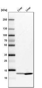 Anti-FABP1 Antibody