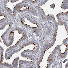 Anti-DNALI1 Antibody