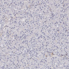 Anti-LMOD1 Antibody