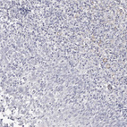 Anti-LMOD1 Antibody