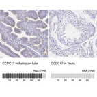 Anti-CCDC17 Antibody