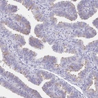 Anti-CCDC17 Antibody